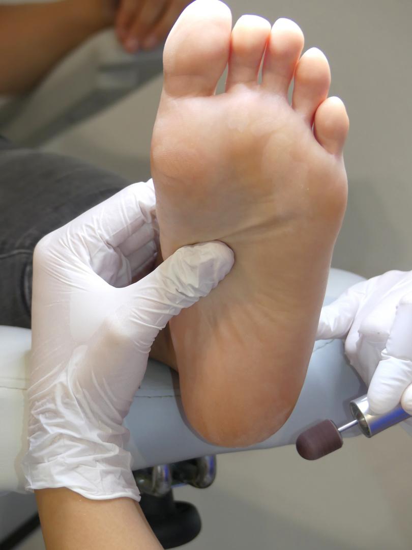 Foot Care Laval